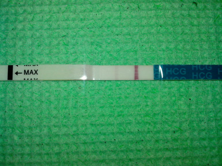 Это беременность?