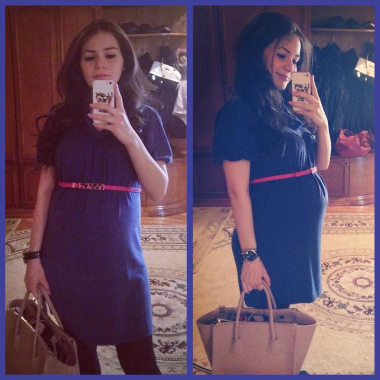 Визит к Гине. УЗИ. Обвитие (33 недели)