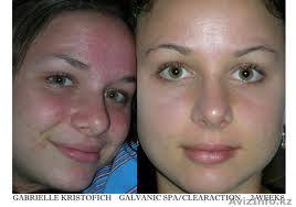 Простое решение больших проблем