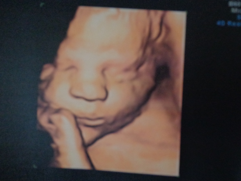 35 недель и 4 дня