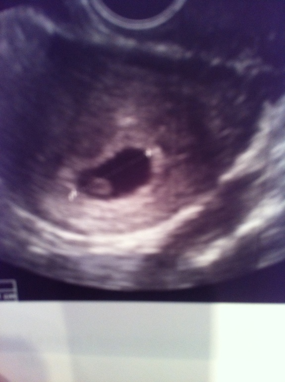 Ура!!! У нас все хорошо