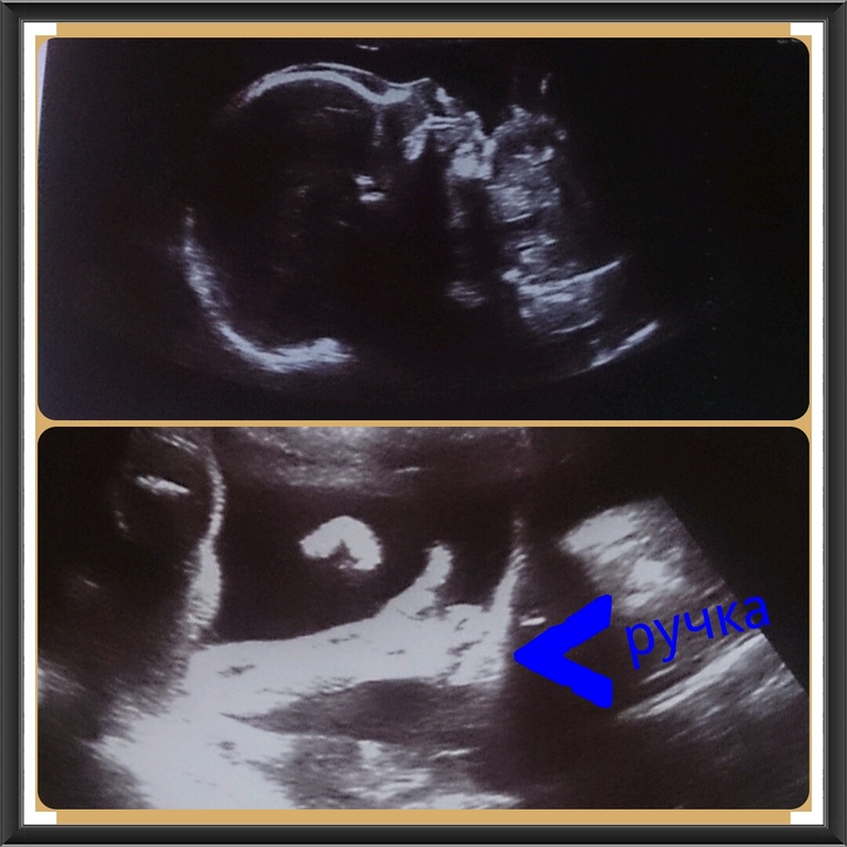 второе узи и жесты доченьки