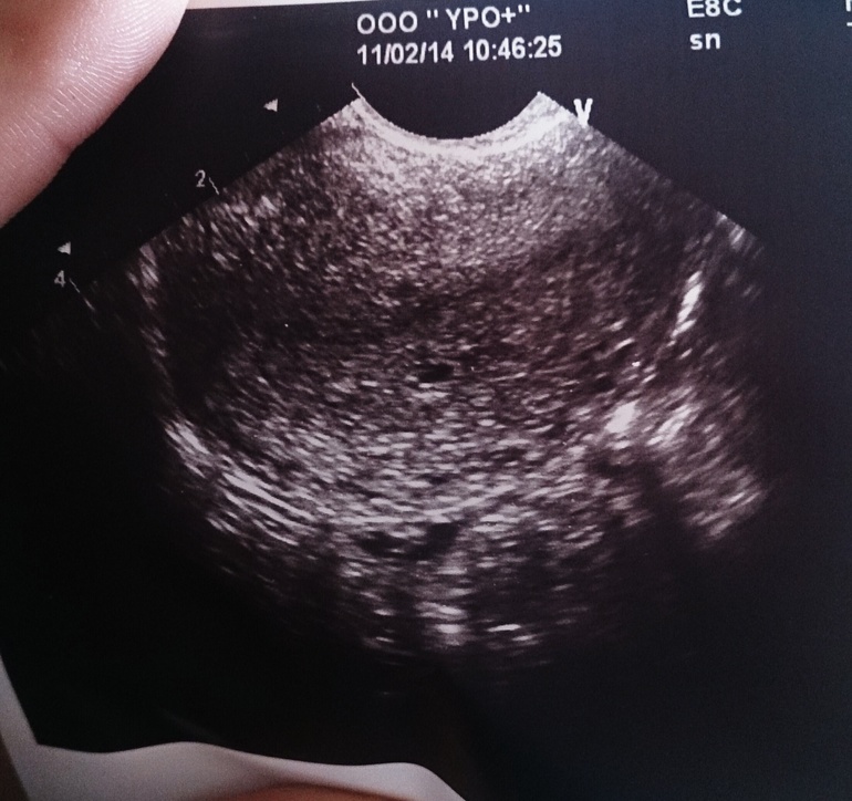 Мой подарок на день рождения))))