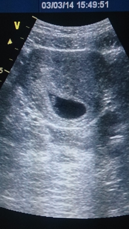 Мой подарок на день рождения))))