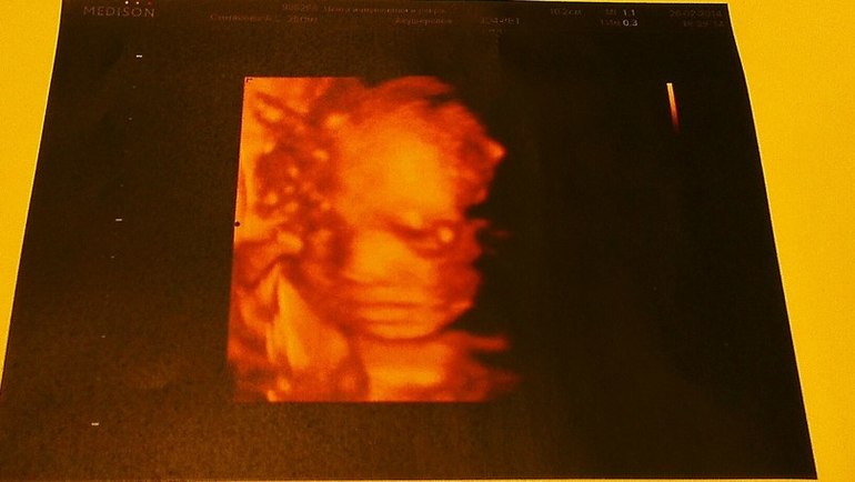 Ура! Узнали наконец-то кто в живоике живет!  :)