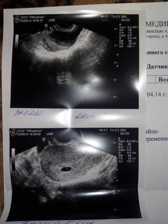 чихну, обслюнявлю и даже плюну!