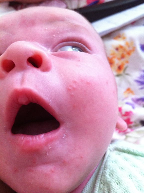 Девочки помогите!!!Что это может быть