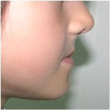 Частые проблемы прикуса у детей