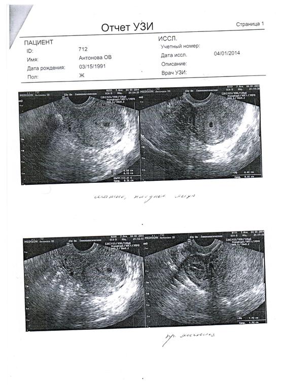 Поменьше слушайте врачей!!!