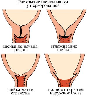 Дюфастон И Шейка Матки При Беременности