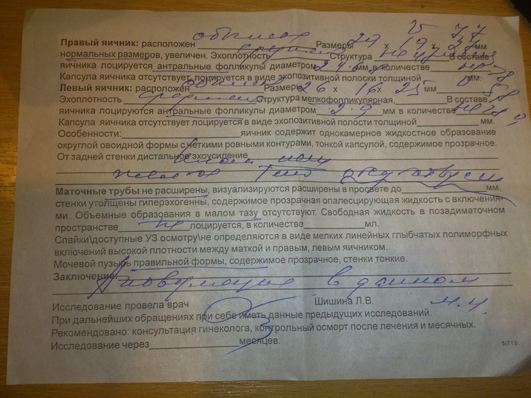 М-эхо,всего лишь 6 мм