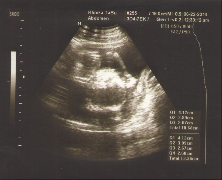 Пришла с узи, счастлива!!! 18 неделька и у нас сыночек!!!