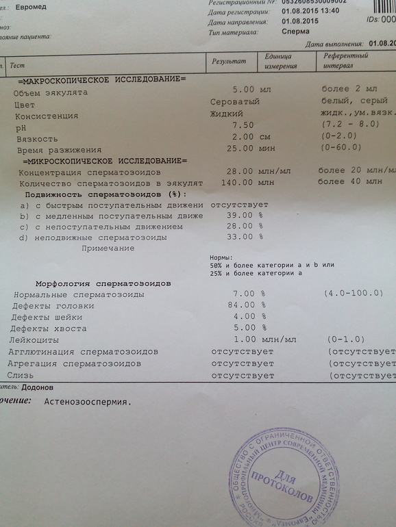 Как массаж простаты самому себе пальцем