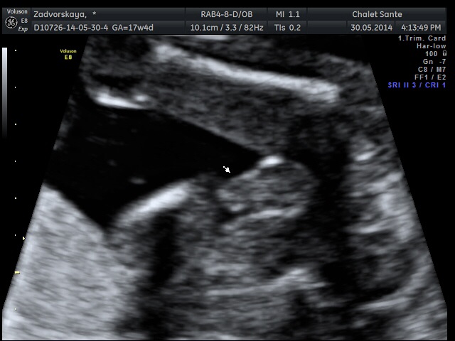 У нас сынок)))