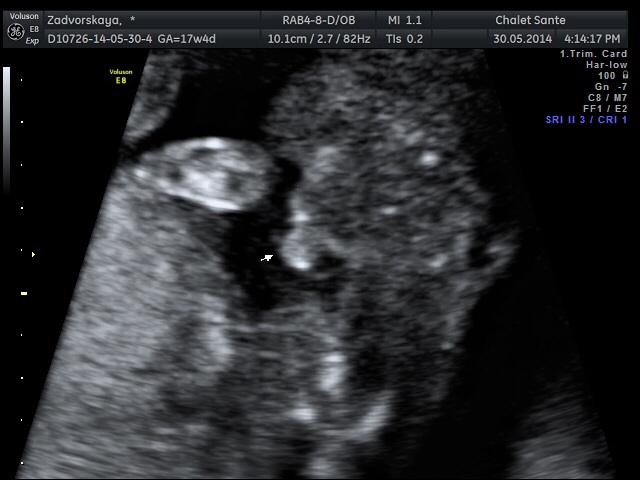 У нас сынок)))