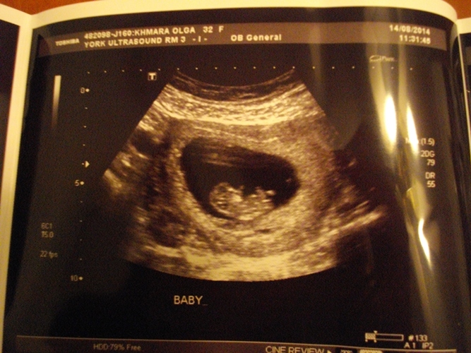 Фото узи в 9 недель беременности фото