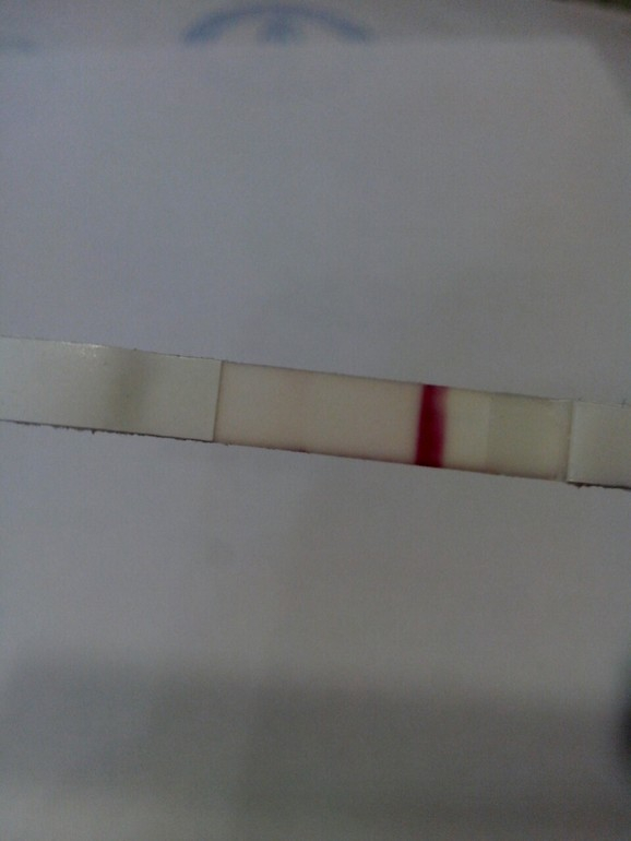 ББ тест..............