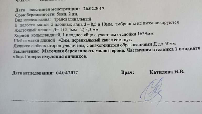 Фото результатов узи беременности Результаты узи - 4 ответов форум Babyblog