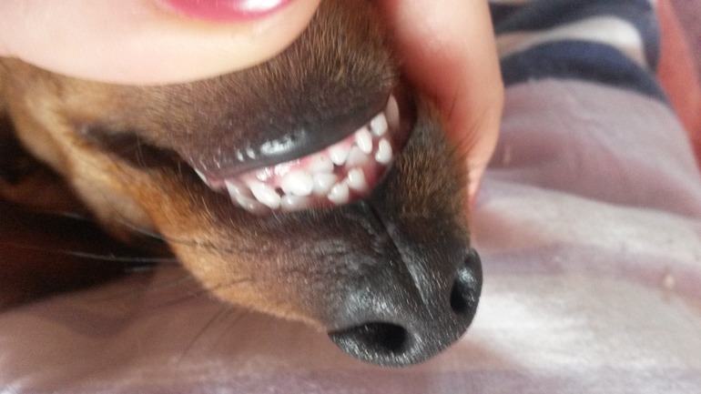 зубы в 2 ряда