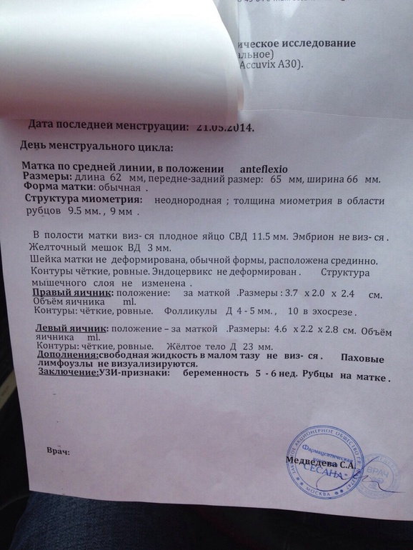 Наше первое узи..;)))