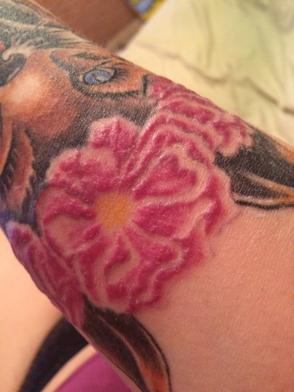 Аллергия на татуировку – правда или миф?