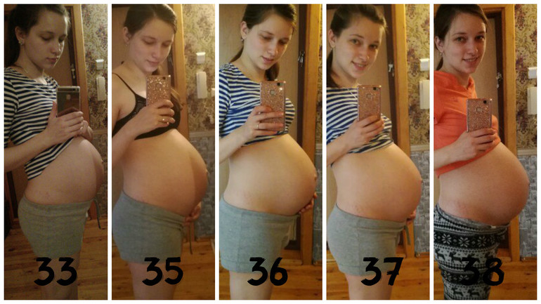 38 39 неделя года. Отпусченный живот при беременности. Опущение живота перед родами. Опущенный живот перед родами. Опущение живота передбродами.
