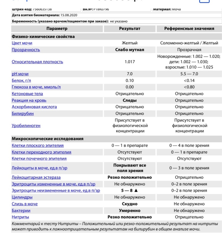 Лейкоциты в моче причины