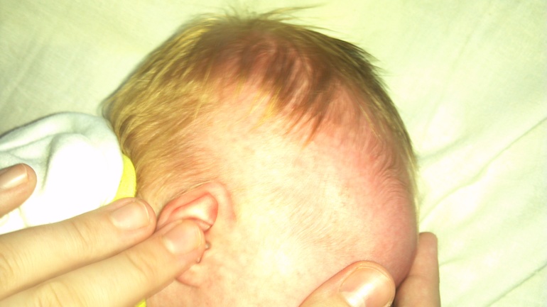 Что за прыщики у дочки появились?