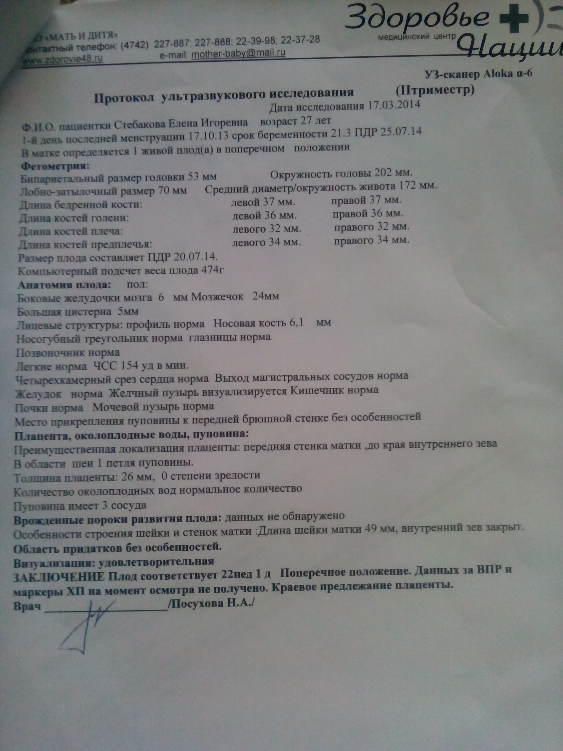 УЗИ, 21 неделька