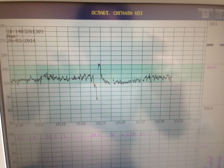 Не нравится мне ктг