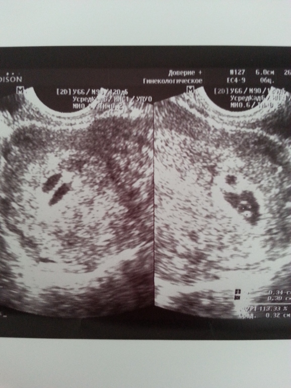 Подскажите