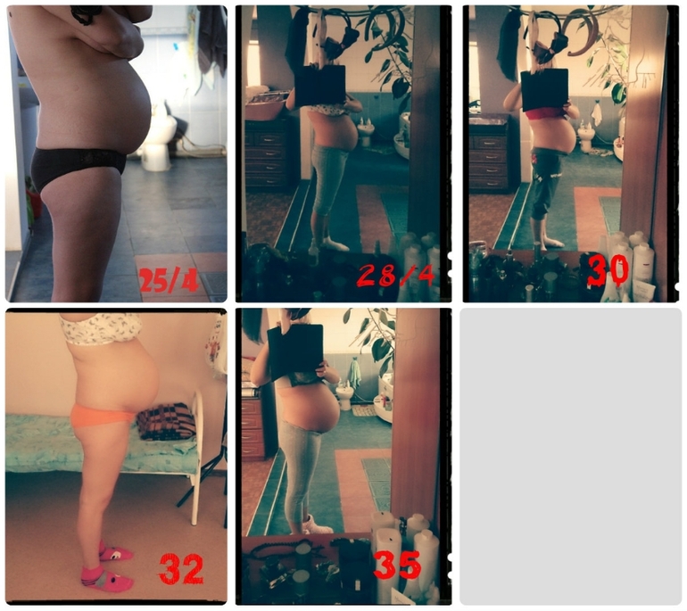 Пузорост с 9 нед по 35 нед