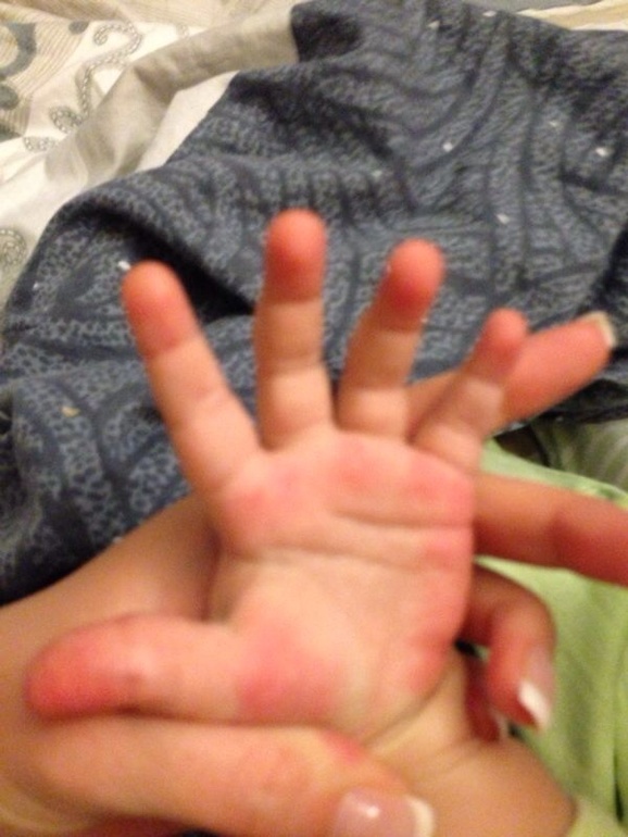 Красно- малиновые руки