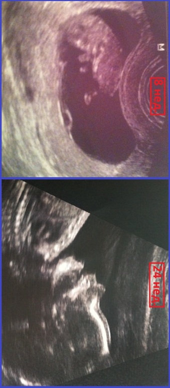 волшебное слово-ДЕКРЕЕЕЕТ!!!!!