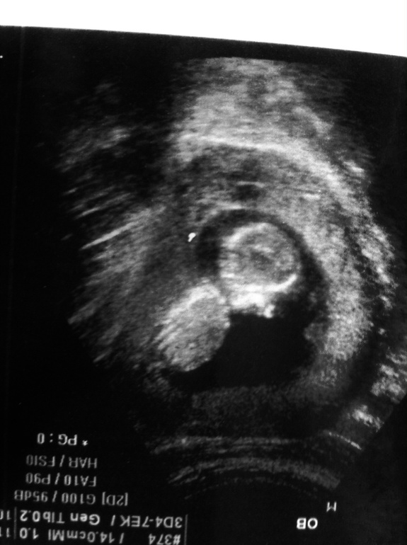 Моя дочка)))