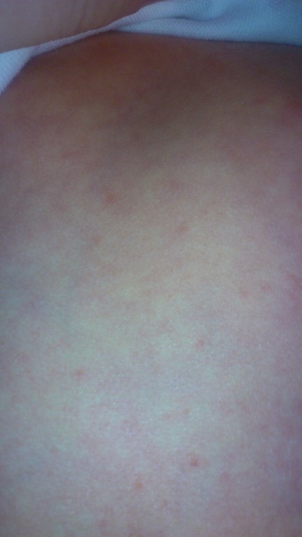 "Цветет" или я съела что-то