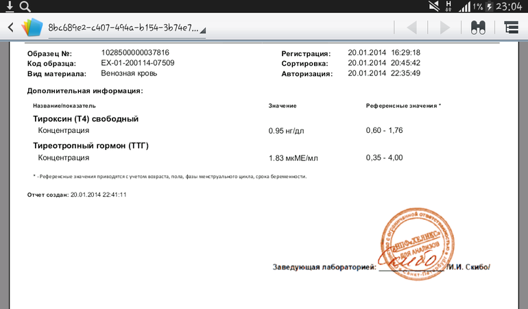 может кто поймет