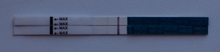 ХГЧ после ЗБ