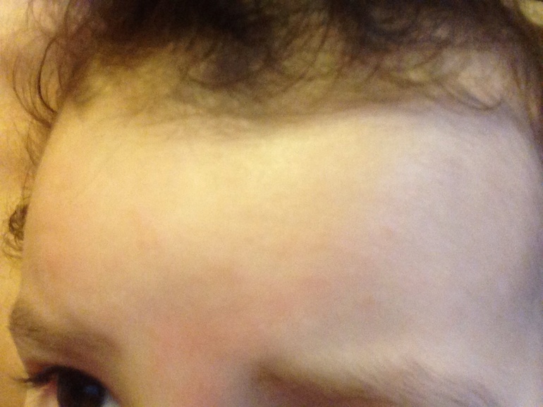 Непонятные высыпания.. Помогите мнением