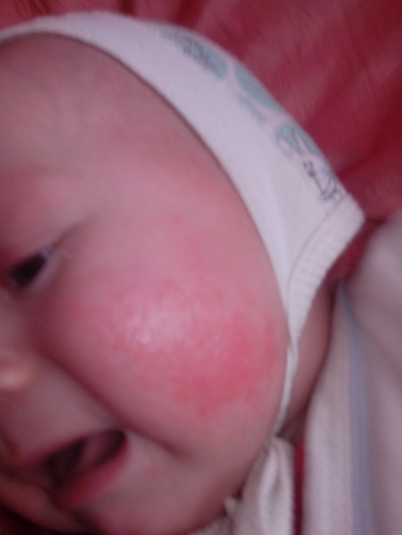 уже не знаю что это и чем лечить это?