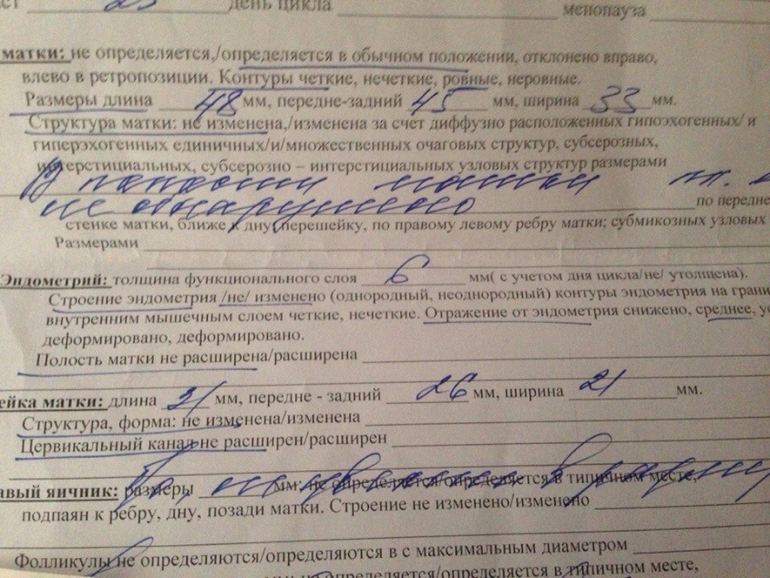 снова я со своими тараканами))