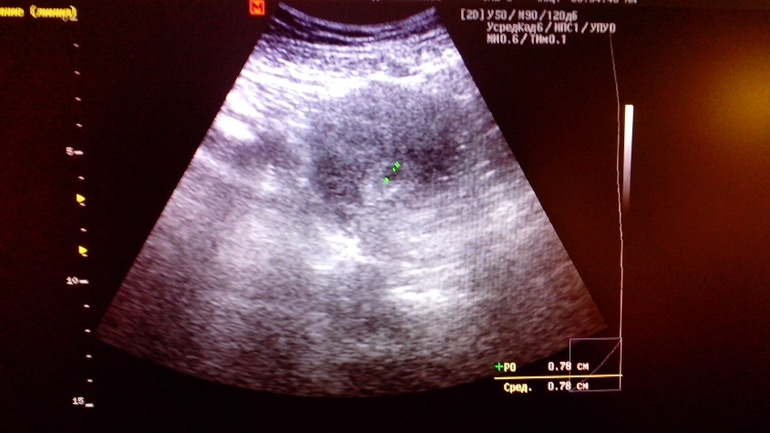 Наконец-то!!!!!