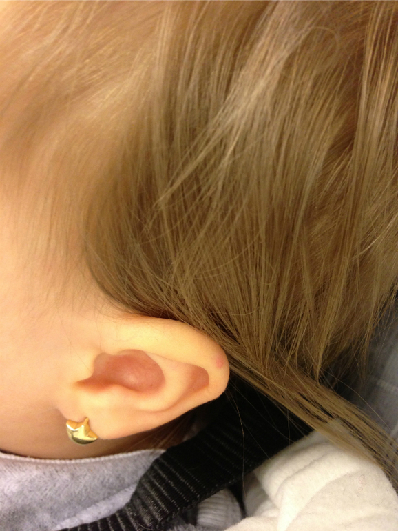 Что за прыщики? Сыпь?