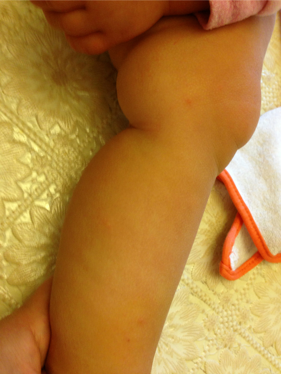 Что за прыщики? Сыпь?