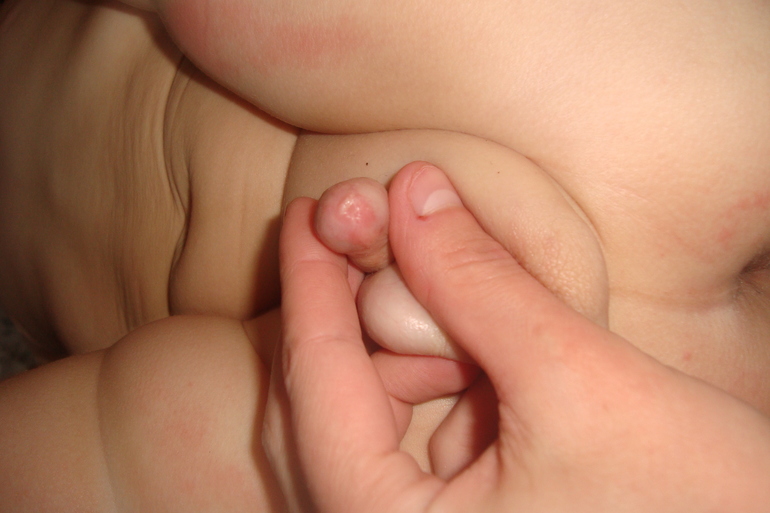 Что-то белое прям на кончике