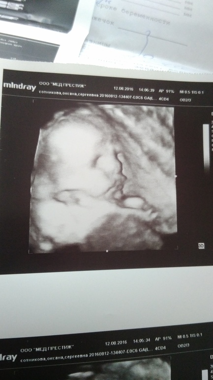 2 скрининг волгоград. скрининг 2 триместра нормы по узи 20 недель. 2 скрининг волгоград. узи скрининг 2 триместра. универсальная панель 2 скрининг.