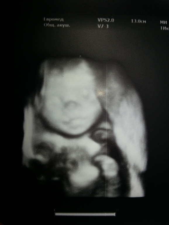 Наши новости :)