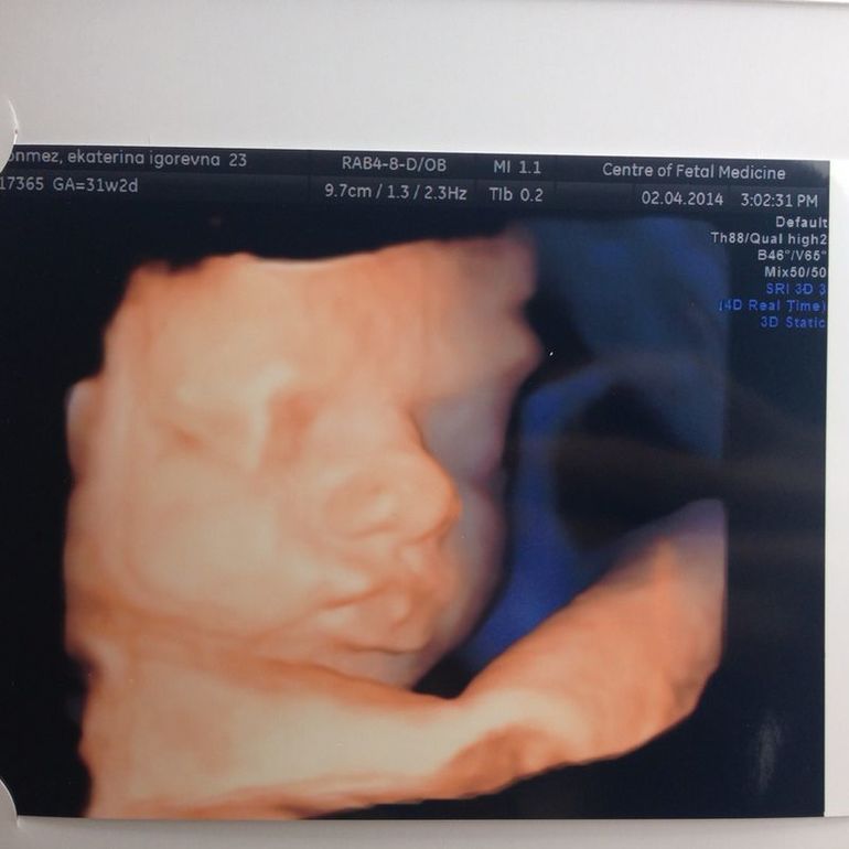 Третье УЗИ) ЦМП СПБ мини отзыв