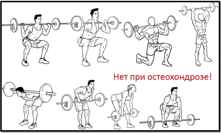 Можно ли заниматься в тренажерном зале с грыжей шейного отдела