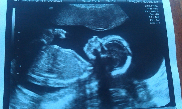 Мой сладенький! 20 н+2